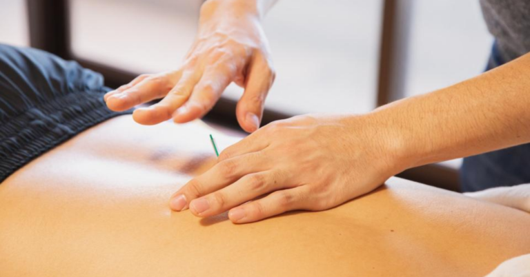 Understanding TCM Acupuncture in Singapore: A Path to Holistic Healing and Wellness